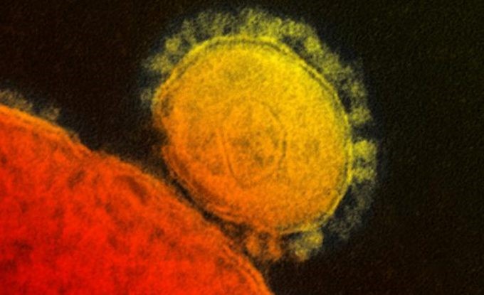 Coronavirus (yellow in below image) attaching itself to a cell (orange)